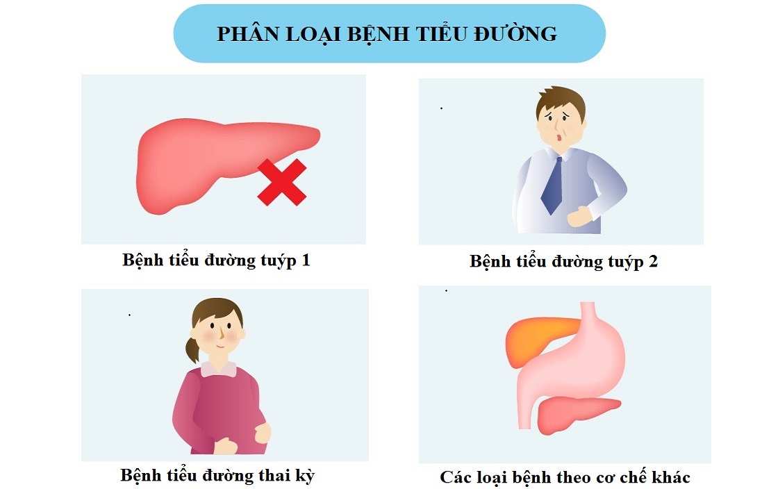 Các tuýp tiểu đường
