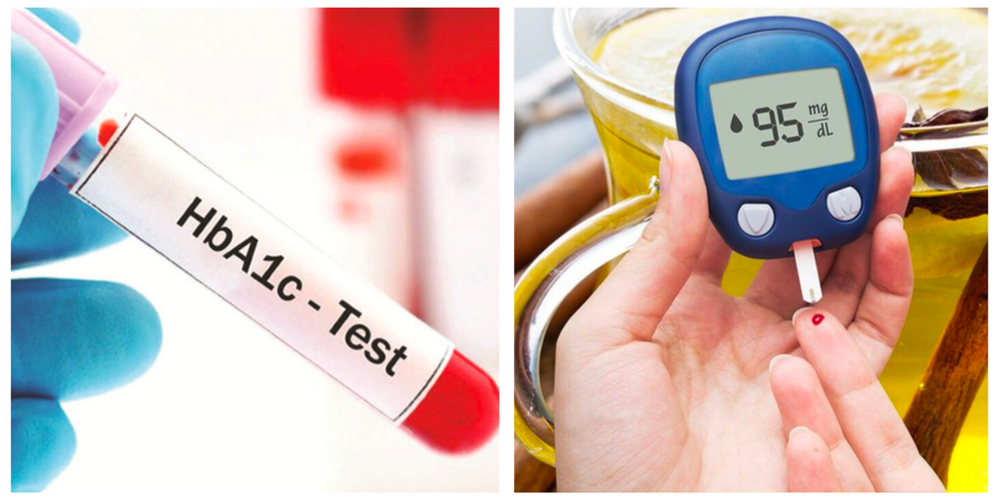 Các xét nghiệm tiểu đường