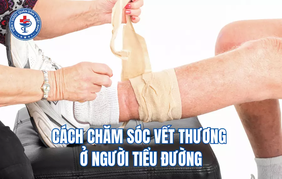 Cách chăm sóc vết thương