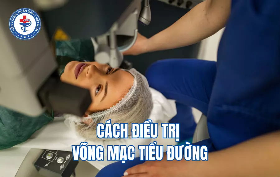 Cách điều trị bệnh võng mạc