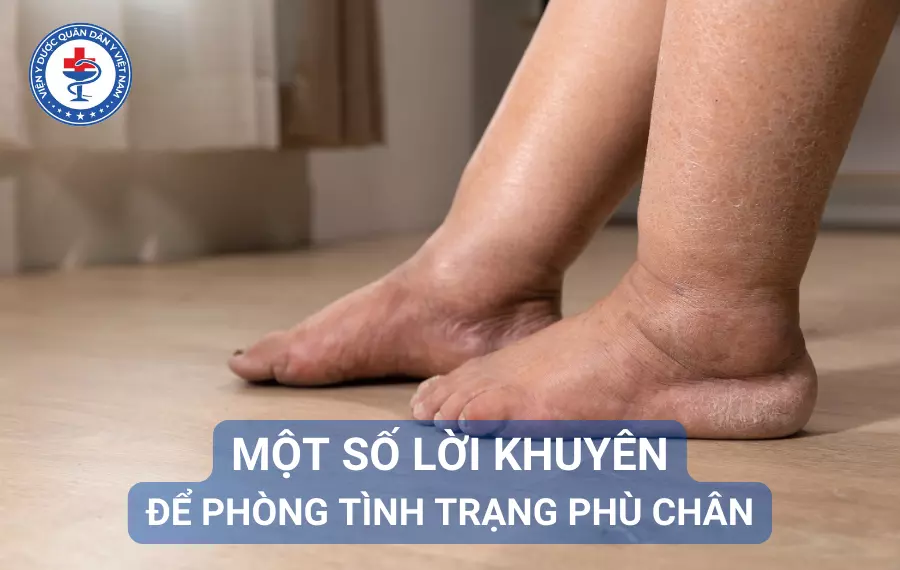 Một số lời khuyên