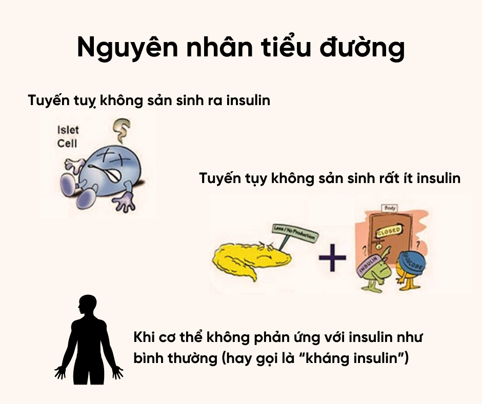 nguyên nhân tiểu đường